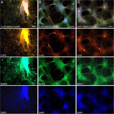 High-resolution spatiotemporal analysis of single serotonergic axons in an in vitro system